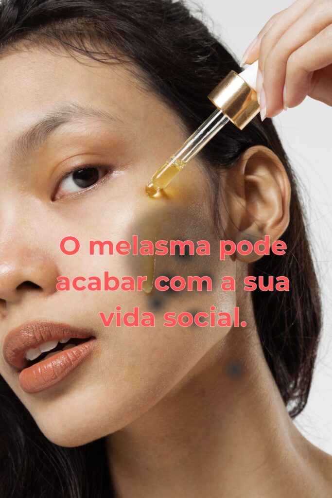 pele, rosto, melasma, tratamento, diagnostico, produtos,